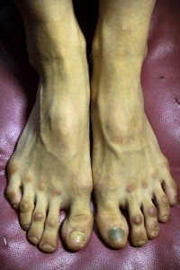 pedicure voeten